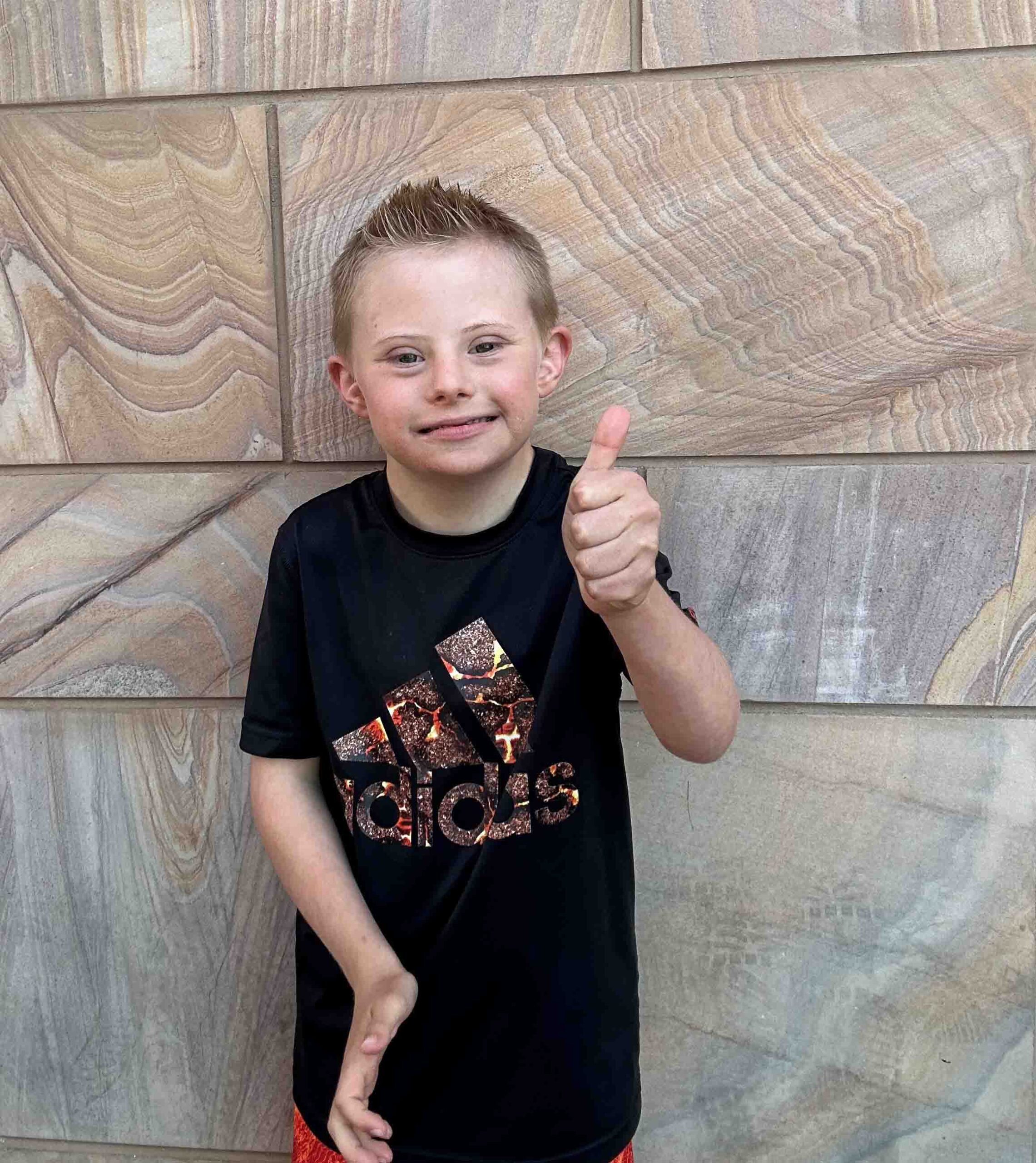 Jax giving a thumbs up Jax our UCP of Central Az ambassador
